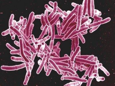 История человечества и история туберкулеза